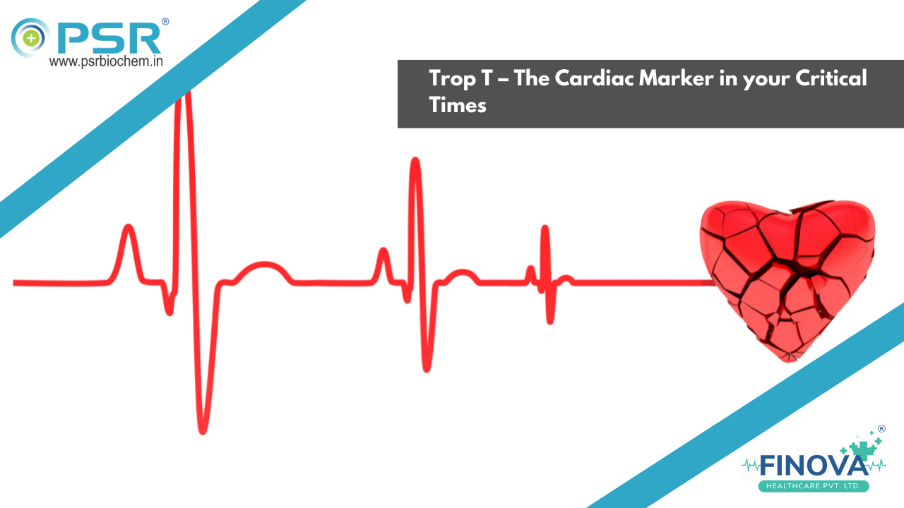 Trop T – The Cardiac Times